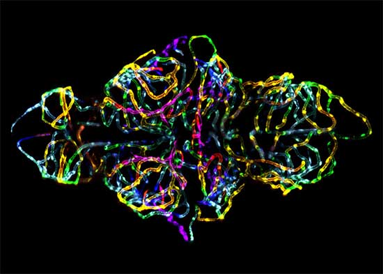 The Blood Brain Barrier in a Live Zebrafish Embryo 20x - Dr. Jennifer L. Peters + Dr. Michael R. Taylor